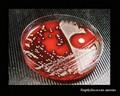 staphylococcus aureus